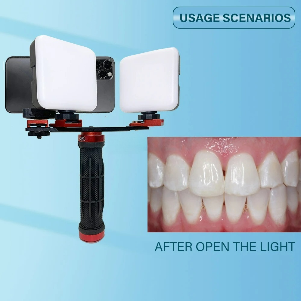 Luce per Fotografia Dentale co - Phone Accessories For Photography recensione e prezzo